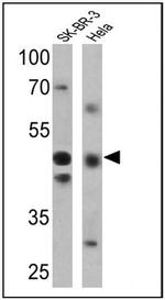RAR gamma-2 Antibody in Western Blot (WB)