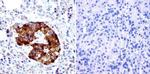 PDX1 Antibody in Immunohistochemistry (IHC)