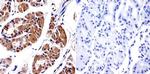 PDX1 Antibody in Immunohistochemistry (IHC)