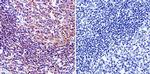 PDX1 Antibody in Immunohistochemistry (IHC)