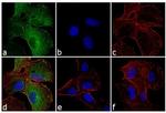 IFIT1 Antibody