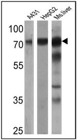 Transferrin Antibody in Western Blot (WB)