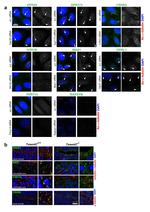GPR20 Antibody in Immunocytochemistry (ICC/IF)