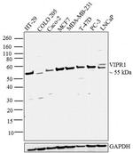 VIPR1 Antibody in Western Blot (WB)