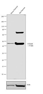 CCKAR Antibody in Western Blot (WB)