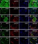 PLP1 Antibody in Immunocytochemistry (ICC/IF)