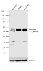 Peripherin Antibody in Western Blot (WB)