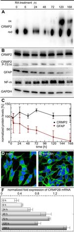 GFAP Antibody