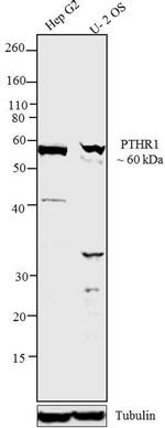 PTH1R Antibody in Western Blot (WB)