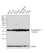 PRDX3 Antibody in Western Blot (WB)
