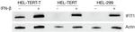IFIT1 Antibody in Western Blot (WB)