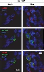 IFIT1 Antibody in Immunocytochemistry (ICC/IF)