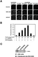 Calreticulin Antibody in Western Blot (WB)