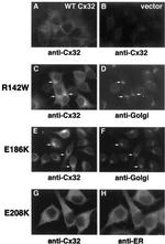 Calreticulin Antibody in Immunocytochemistry (ICC/IF)