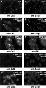Calreticulin Antibody in Immunocytochemistry (ICC/IF)