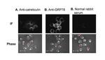 Calreticulin Antibody in Immunocytochemistry (ICC/IF)