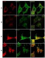 Calreticulin Antibody in Immunocytochemistry (ICC/IF)
