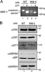 Calreticulin Antibody in Western Blot (WB)