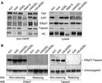Calreticulin Antibody in Western Blot (WB)
