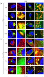 Calreticulin Antibody in Immunocytochemistry (ICC/IF)