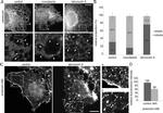 Calreticulin Antibody in Immunocytochemistry (ICC/IF)