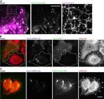 Calreticulin Antibody in Immunocytochemistry (ICC/IF)