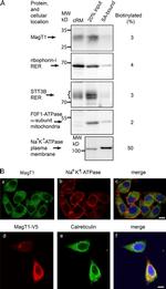 Calreticulin Antibody in Immunocytochemistry (ICC/IF)