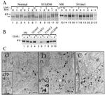 Calreticulin Antibody in Western Blot (WB)