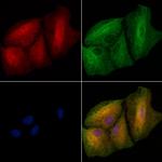 LGALS3BP Polyclonal Antibody