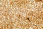 RNaseH1 Antibody in Immunohistochemistry (Paraffin) (IHC (P))