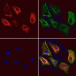 RNaseH1 Polyclonal Antibody