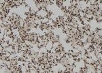 RNaseH1 Antibody in Immunohistochemistry (Paraffin) (IHC (P))