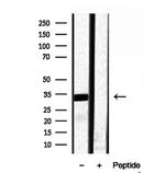 RNaseH1 Antibody in Western Blot (WB)