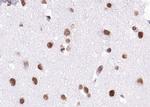 BRD7 Antibody in Immunohistochemistry (Paraffin) (IHC (P))