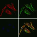 GOLPH3 Polyclonal Antibody