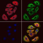 HMGCS1 Polyclonal Antibody