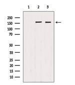 PPFIA1 Polyclonal Antibody