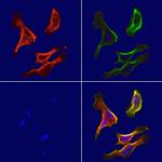 SUCLA2 Polyclonal Antibody