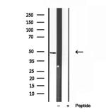 SUCLA2 Antibody in Western Blot (WB)