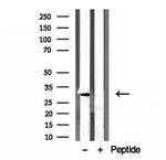 GNMT Antibody in Western Blot (WB)