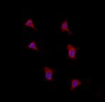 LONP1 Antibody in Immunocytochemistry (ICC/IF)