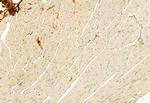LONP1 Antibody in Immunohistochemistry (Paraffin) (IHC (P))