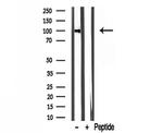LONP1 Antibody in Western Blot (WB)