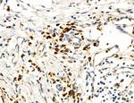 MPV17 Polyclonal Antibody