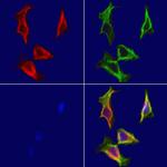 MYH7 Polyclonal Antibody