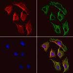 PSAT1 Polyclonal Antibody