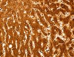 PYGL Antibody in Immunohistochemistry (Paraffin) (IHC (P))