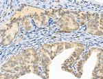 SULT1E1 Antibody in Immunohistochemistry (Paraffin) (IHC (P))