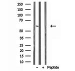 UGT2B7 Antibody in Western Blot (WB)