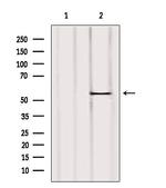 UGT2B7 Antibody in Western Blot (WB)